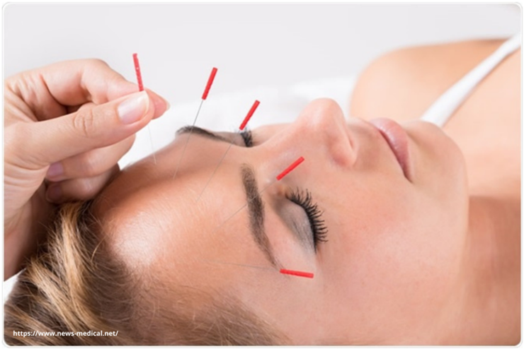 b60010_6cf6d3935d124f9f82b2a010791a1449_mv2